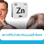 مصرف قرص زینک بعد از کاشت مو