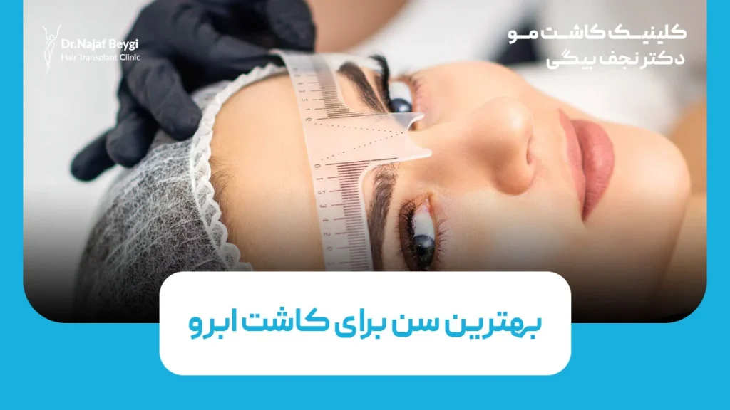 بهترین سن برای کاشت ابرو