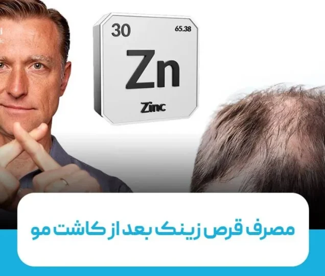 آیا مکمل زینک برای رشد بهتر موهای کاشته شده موثر است
