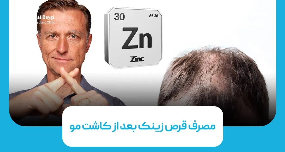 آیا مکمل زینک برای رشد بهتر موهای کاشته شده موثر است؟