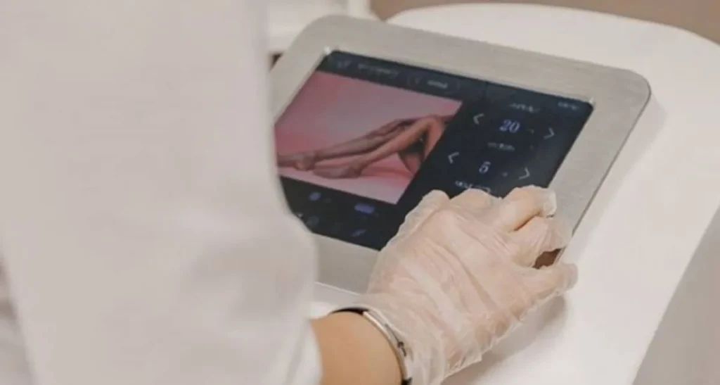 انتقال زگیل تناسلی از لیزر موهای زائد