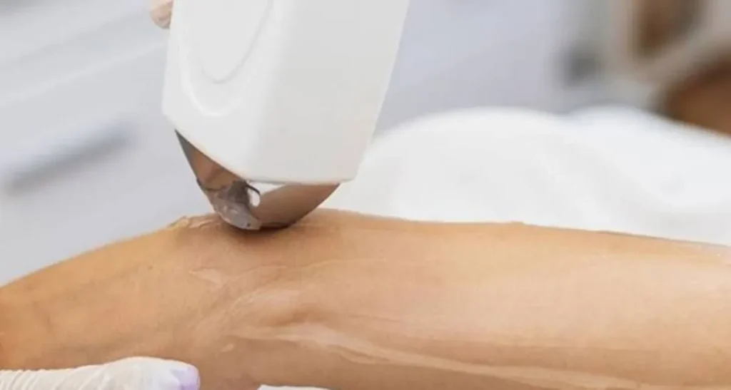 چرا آب زدن به پوست بعد از لیزر خوب نیست