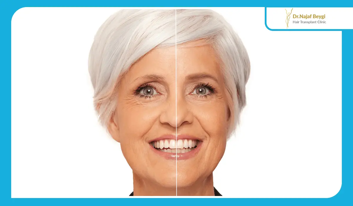 بررسی الگوی رایج ریزش ابرو در اثر ژنتیک
