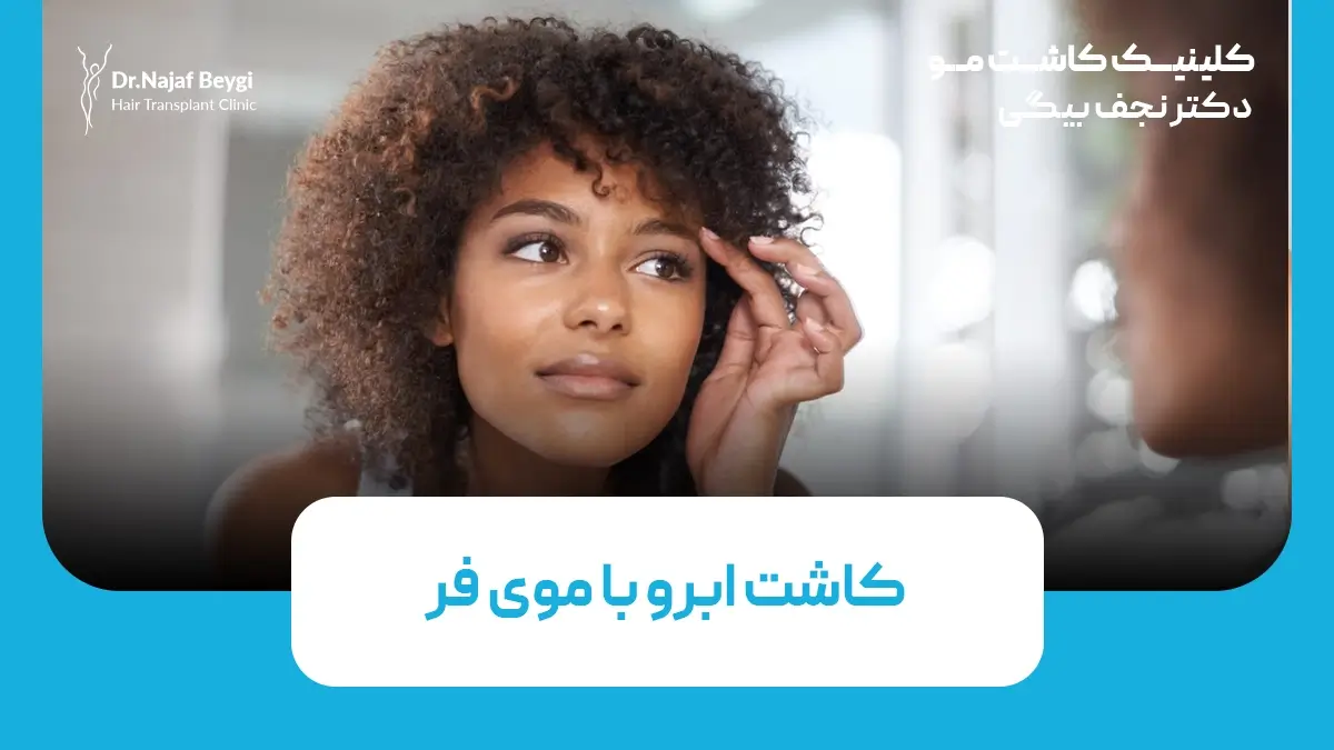 کاشت مو برای افراد با موی فر