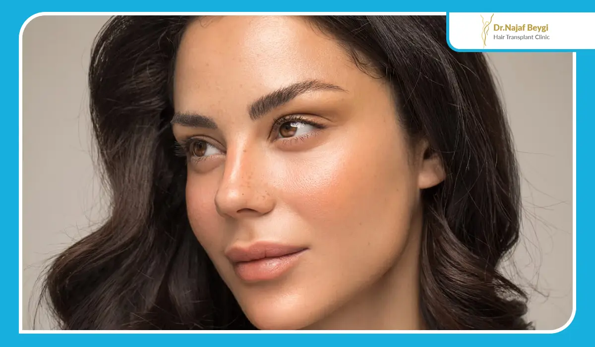 نکات کلیدی درباره کاشت ابرو برای افراد با ریزش موی ژنتیکی