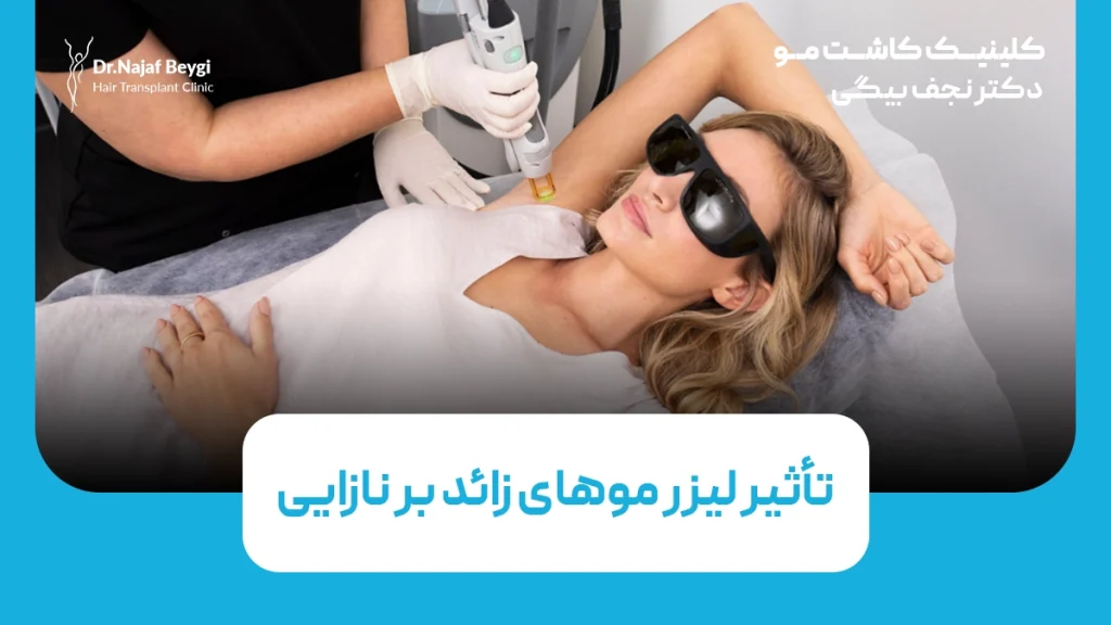 تأثیر لیزر موهای زائد بر نازایی