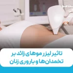 تاثیر لیزر موهای زائد بر تخمدان‌ها و ناباروری زنان