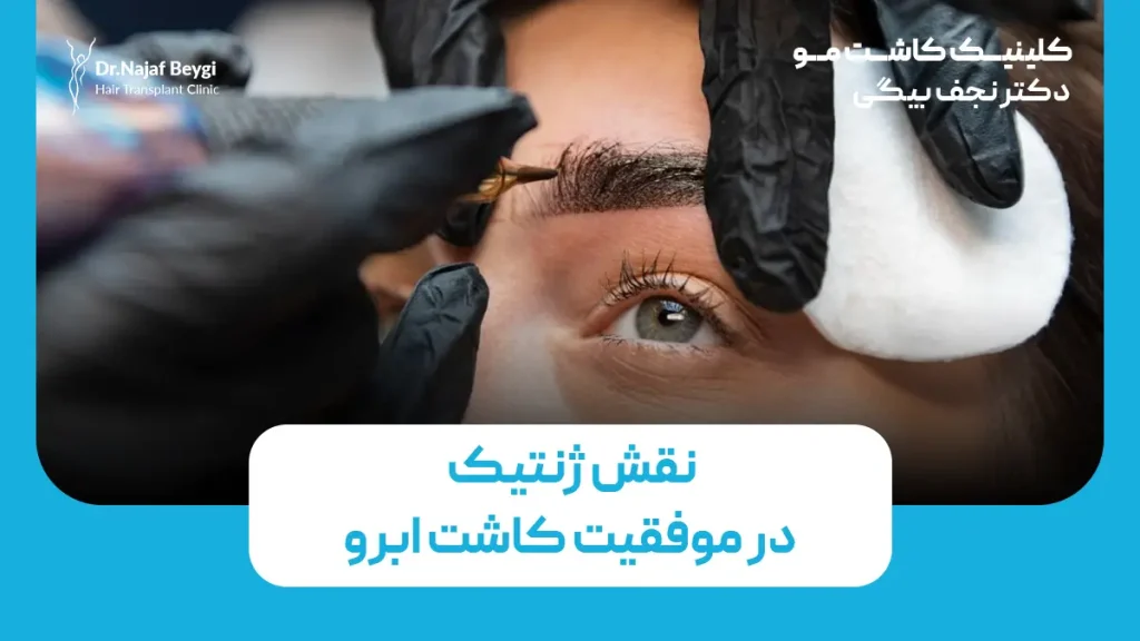 نقش ژنتیک در موفقیت کاشت ابرو