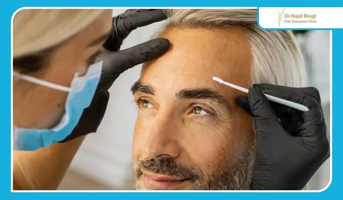 نقش ژنتیک در نتیجه کاشت ابرو چیست؟