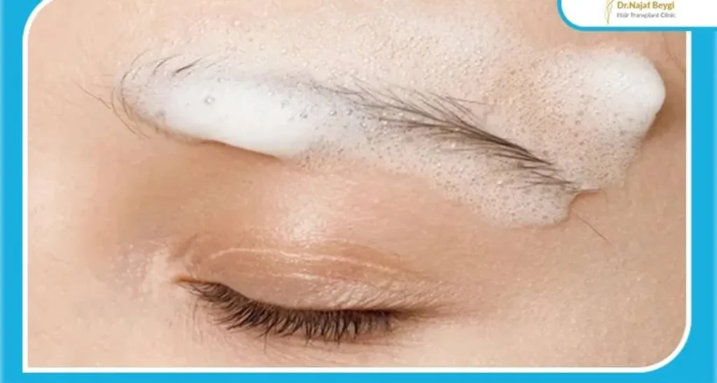 زمان و نحوه شستشوی ابرو بعد از کاشت