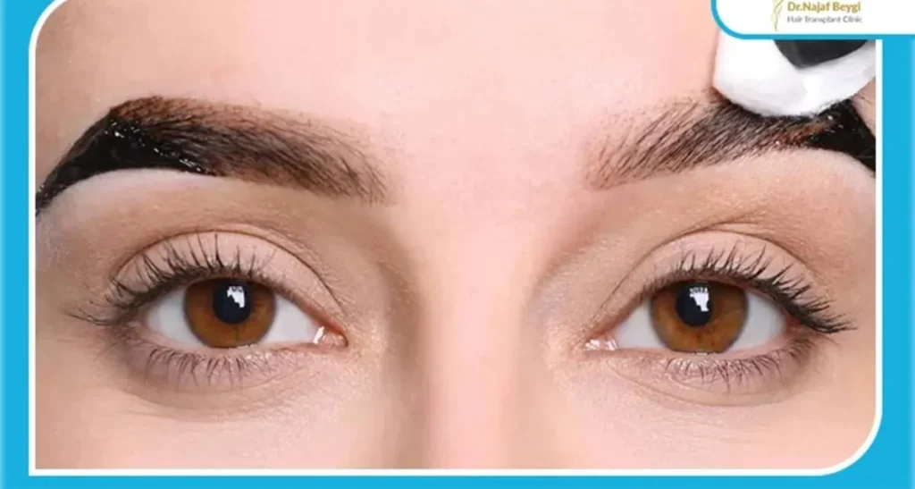 مراقبت های ضروری پس از کاشت ابرو