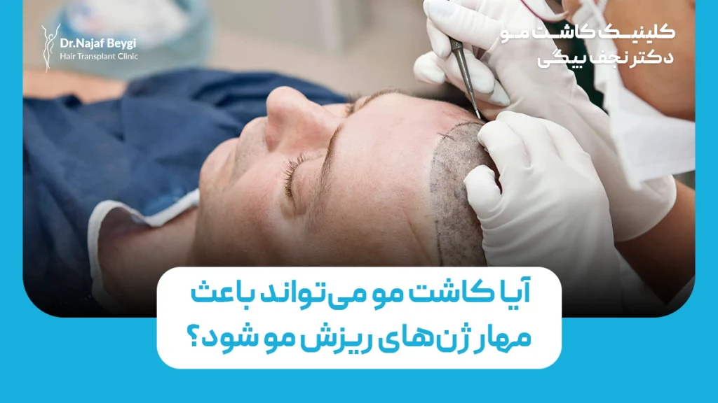 آیا کاشت مو می‌تواند باعث مهار ژن‌های ریزش مو شود