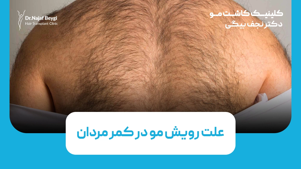 علت رویش مو در کمر مردان