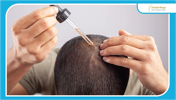 راهکارهایی برای مقابله با ژن‌های ریزش مو پس از کاشت