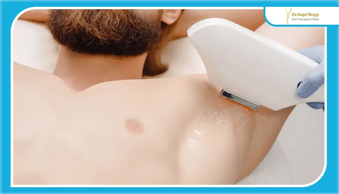 آیا لیزر باعث کاهش تعریق می‌شود؟
