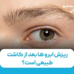 ریزش ابرو ها بعد از کاشت طبیعی است