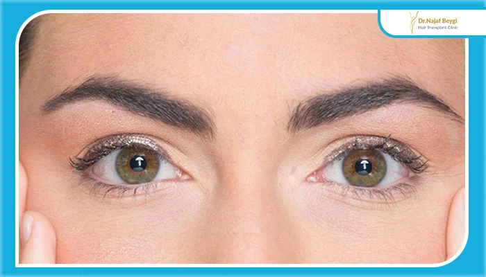 شوک ریزش بعد از کاشت ابرو چطور اتفاق می افتد؟