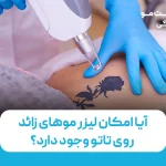 آیا امکان لیزر زائد روی تاتو وجود دارد؟