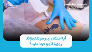 آیا امکان لیزر زائد روی تاتو وجود دارد؟