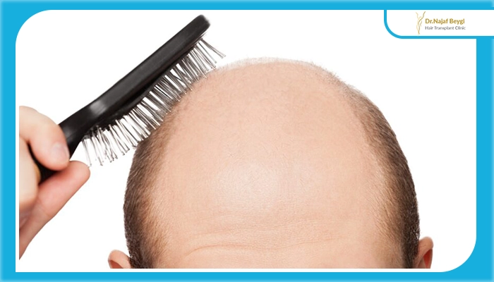 آیا کتوژنیک با ریزش مو مرتبط است؟