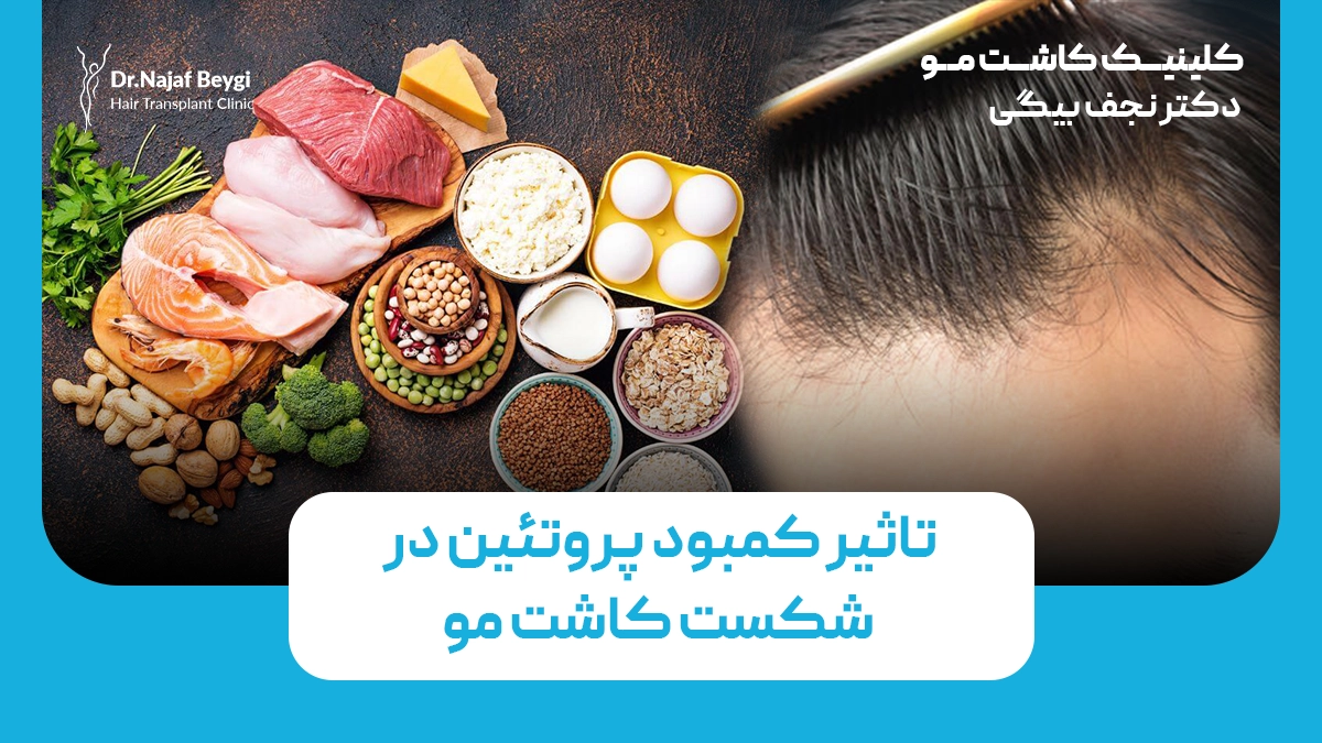 تاثیر کمبود پروتئین در شکست کاشت مو