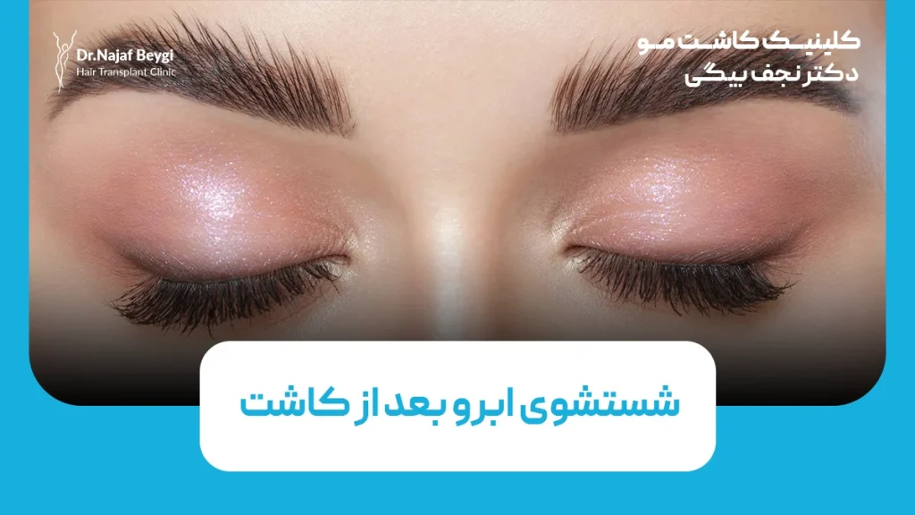 شستشوی ابرو بعد از کاشت