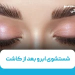 شستشوی ابرو بعد از کاشت