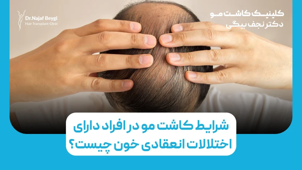 شرایط کاشت مو در افراد دارای اختلالات انعقادی خون چیست؟