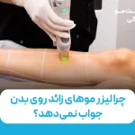 چرا لیزر زائد روی بدن جواب نمی‌دهد؟