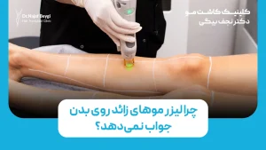 چرا لیزر زائد روی بدن جواب نمی‌دهد؟