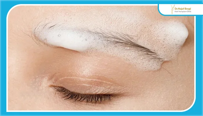 چرا شستشوی ابرو بعد از کاشت اهمیت دارد؟