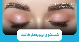 شستشوی ابرو بعد از کاشت؛ راهنمای کامل مراقبت و زمان مناسب شستشو