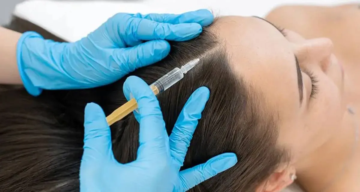 علت ریزش مو بعد از پی آر پی