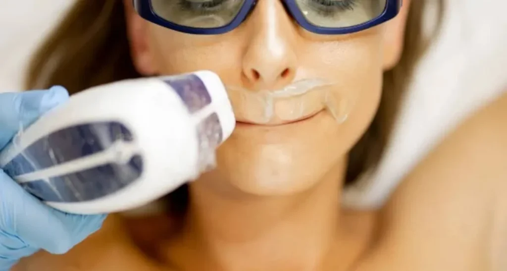 تاثیر لیزر موهای زائد بر موهای زیر پوستی