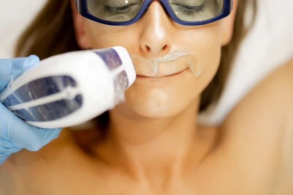 مزایای لیزر نسبت به روشهای سنتی در از بین بردن موهای زائد