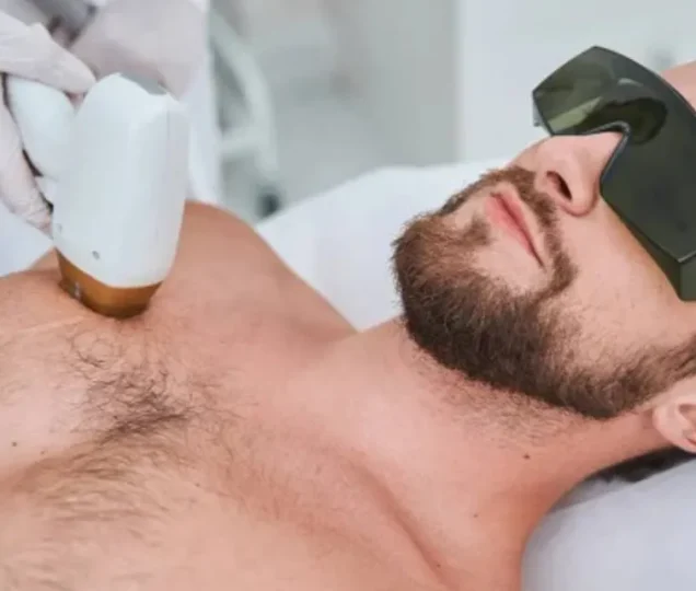 تاثیر لیزر بر موهای زیر پوستی؛ درمان قطعی؟