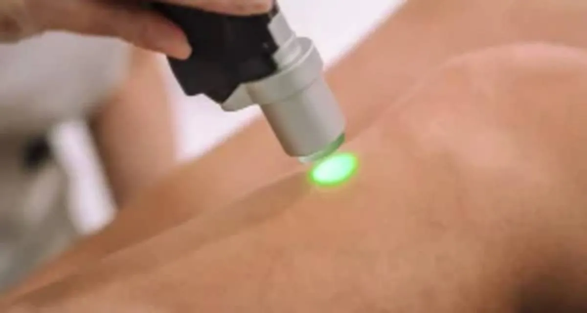 چه تعداد شات لیزر برای کل بدن لازم است؟ بررسی معیارها و عوامل مؤثر