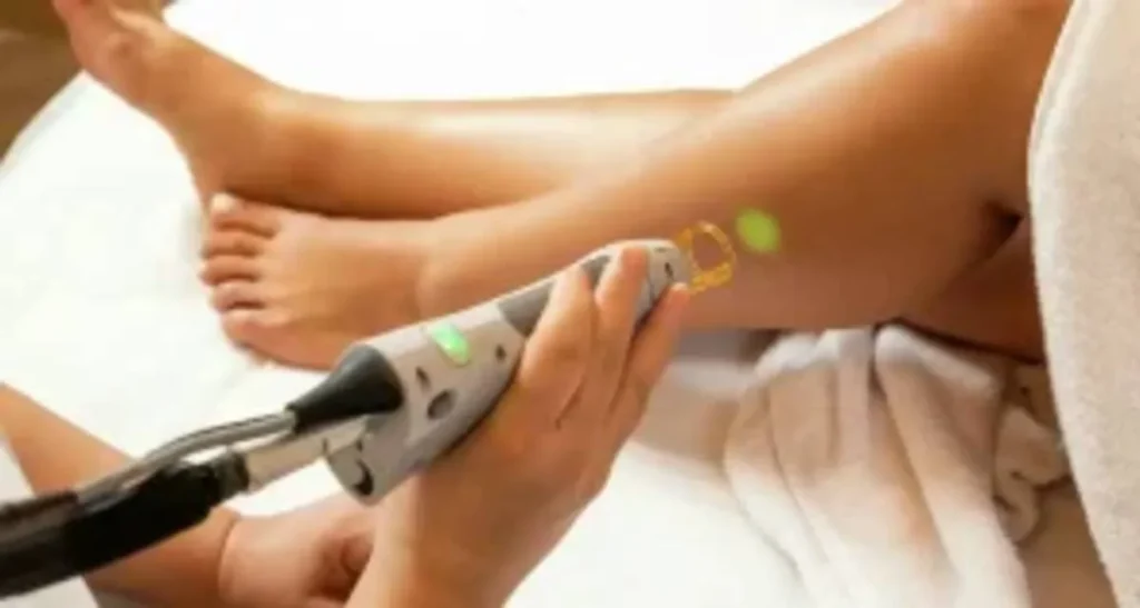 تعداد شات لیزر برای نواحی مختلف بدن چقدر است