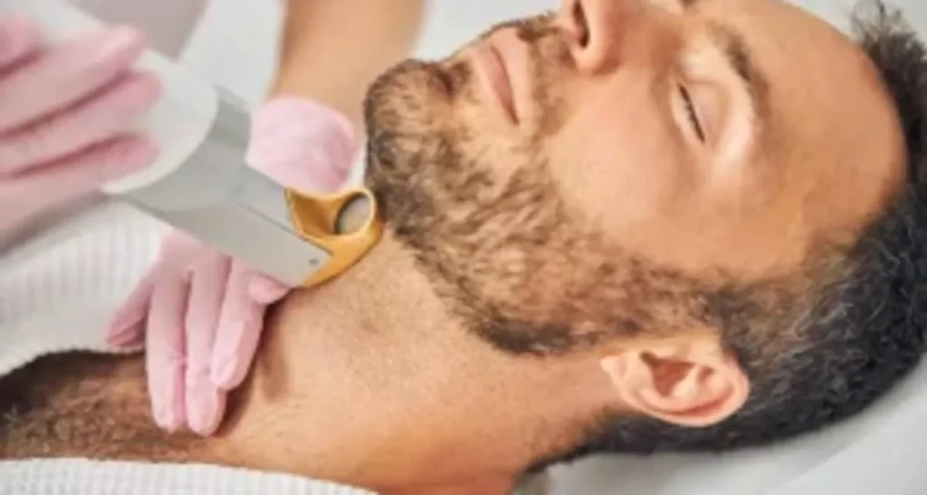 تعداد شات لیزر برای قسمت های مختلف بدن