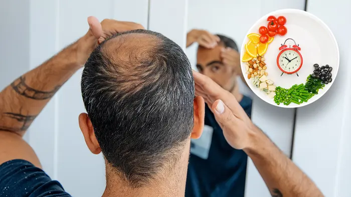 مردی که ریزش موی خود را بررسی می‌کند در کنار تصویر غذاهای مناسب رژیم فستینگ