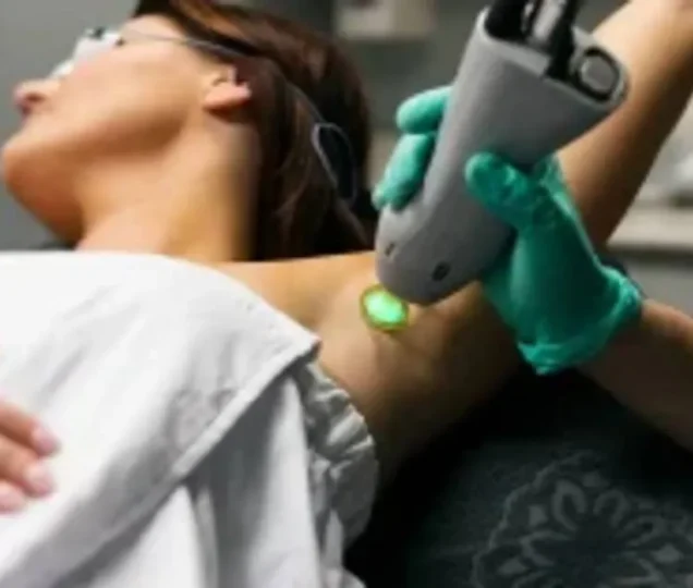 آیا لیزر موهای زائد برای افراد دارای موی ضخیم و تیره مؤثرتر است؟