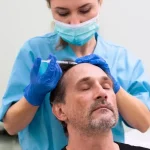 ریزش مو بعد از پی آر پی؛ آیا این اتفاق طبیعی است؟