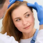 آیا میتوان همزمان کاشت مو و کاشت ابرو انجام داد؟