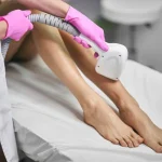 آیا می‌توان با پوست آفتاب‌ سوخته لیزر انجام داد؟