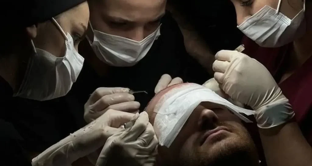 کاشت مو در نیاوران تهران