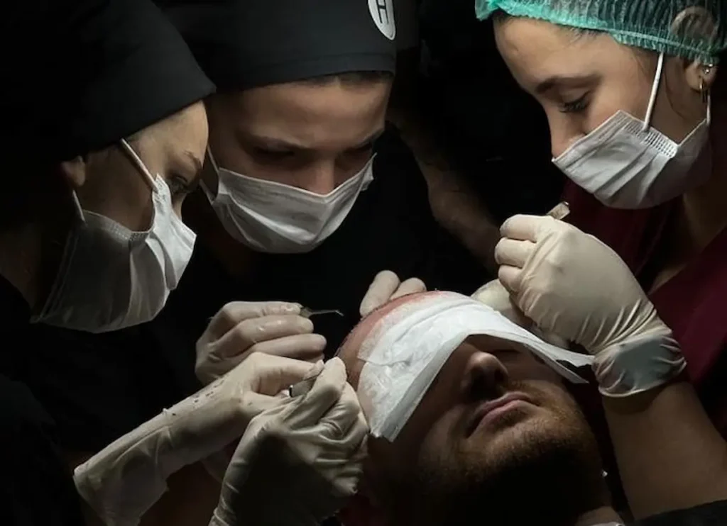 کاشت مو در نیاوران تهران