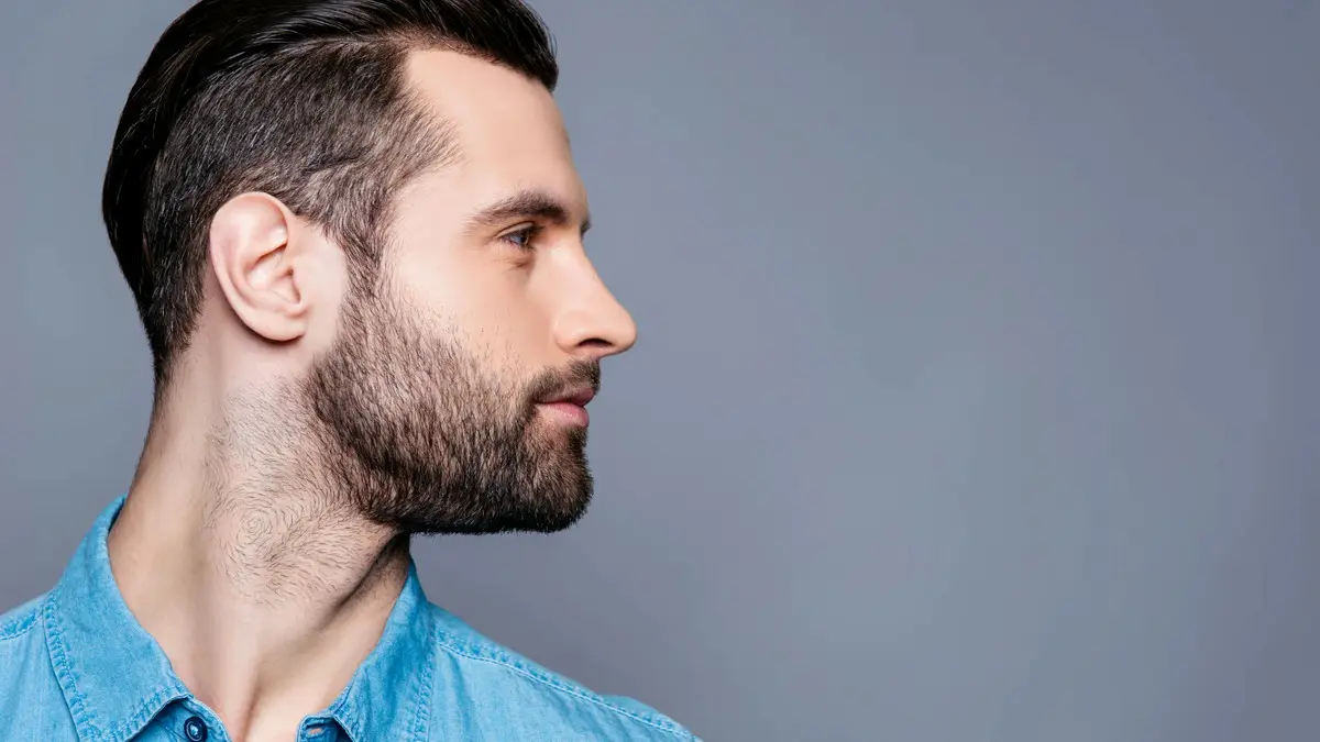 کاشت مو در خط ریش؛ مناسب چه کسانی است؟