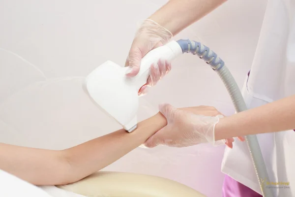 لیزر موهای زائد و نحوه عملکرد آن