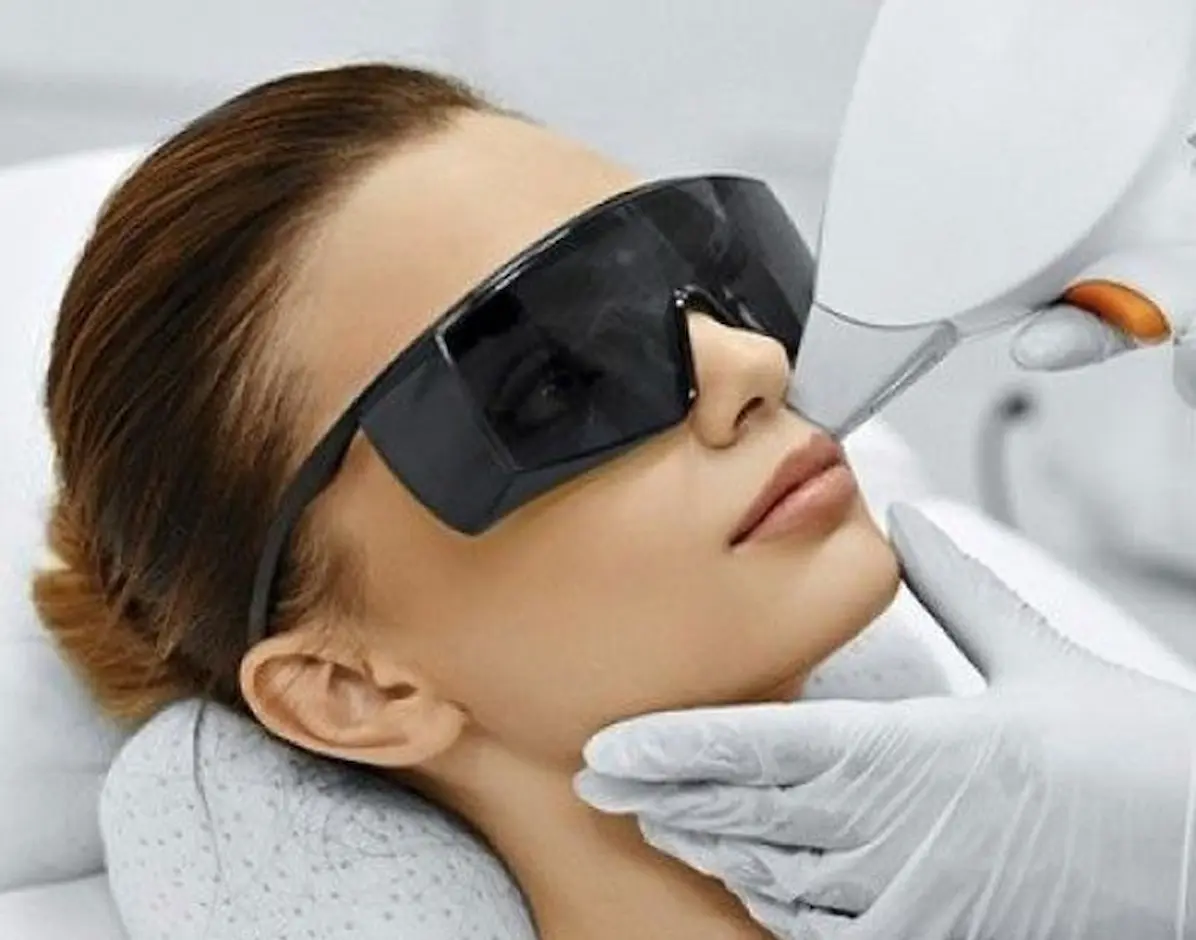 بهترین زمان سال برای شروع لیزر موهای زائد