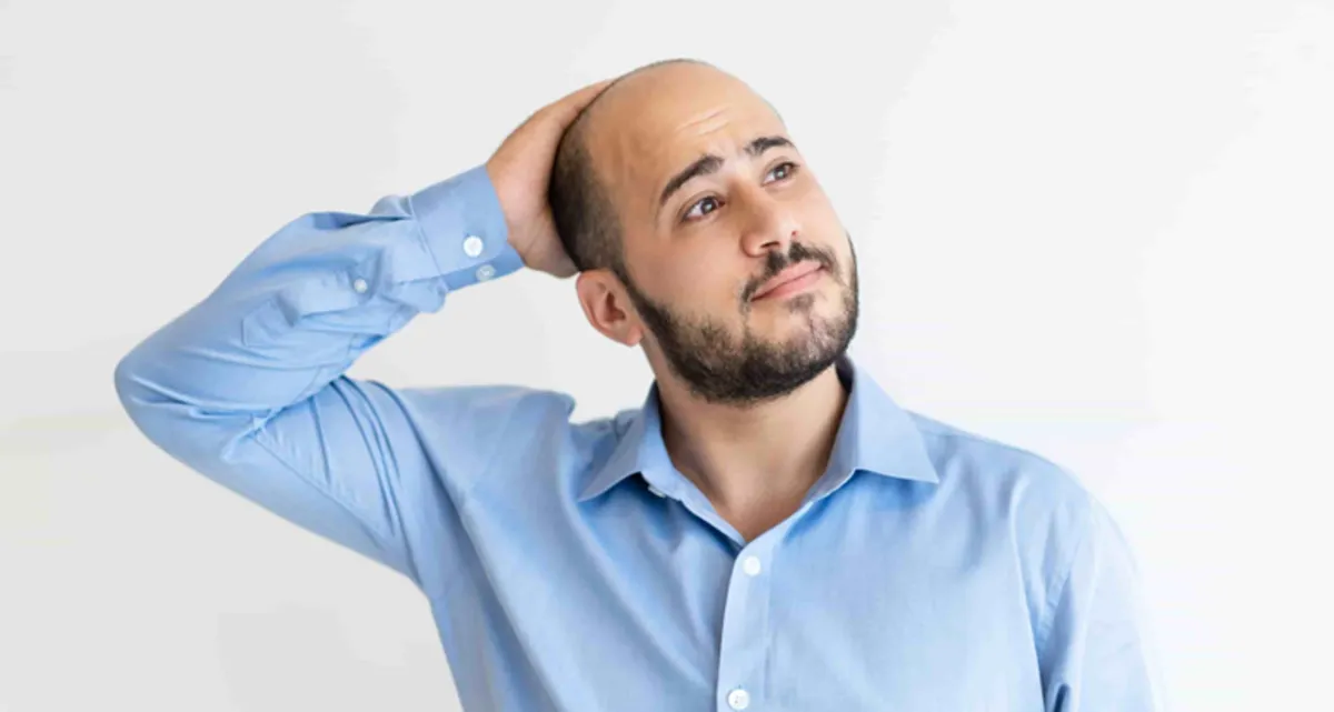 کاشت مو برای افراد مبتلا به ایدز